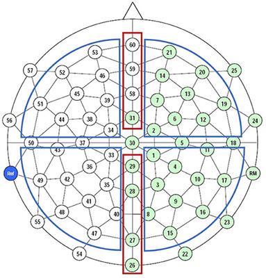 Negative affect increases reanalysis of conflicts between discourse context and world knowledge